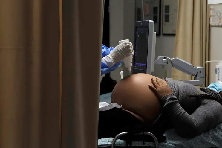 Una mujer embarazada mientras se somete a una ecografía. El fuerte aumento de las muertes de mujeres embarazadas por covid-19 preocupa a las autoridades brasileñas, que en medio de un agravamiento de la pandemia han pedido aplazar planes de embarazo y aceleran la vacunación de las futuras madres.