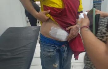 Lino Damián Barreto Monges (27) sufrió una herida en el abdomen.