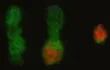 reproducen-en-celulas-humanas-modificaciones-cromosomicas-propias-del-cancer-91113000000-1090578.jpg