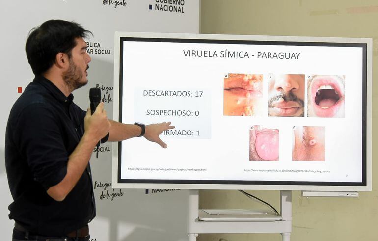 Imagen de archivo de la conferencia de prensa del Ministerio de Salud, a cargo del Dr. Guillermo Sequera.