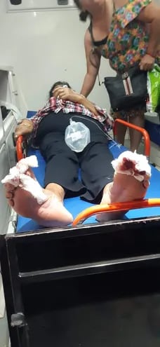 Las pirañas destruyeron cuatro dedos de los pies de una mujer adulta en la tarde del martes. Fue sometida a cirugía reconstructiva.