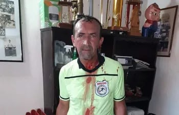 Árbitro agredido por simpatizantes, en el estadio "Club Capitán Pedro Caballero", de la ciudad de Tobatí.