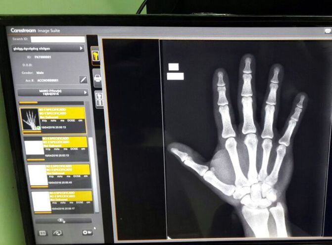 Con Sistema De Radiologia Computada Economia Abc Color
