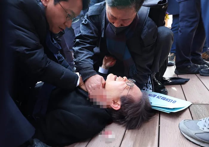 El líder del Partido Democrático (PD) surcoreano, Lee Jae-myung tras ser apuñalado este martes en el cuello durante un acto público en la ciudad de Busan y desde donde ha sido trasladado a la capital surcoreana para ser operado de urgencia debido al grave daño en la yugular.