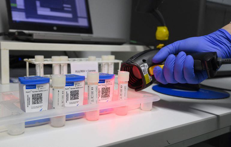 Científicos desarrollan nuevo test para detectar anticuerpos contra el covid. (AFP)