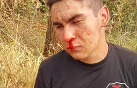 Uno de los guardias de la seguridad golpeado por los campesinos de Estancia Pindó