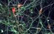 Neuronas dopaminérgicas obtenidas de células madres.