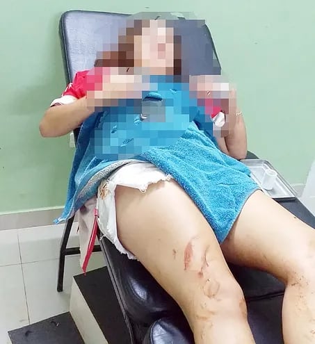 La adolescente recibió tres heridas en el ataque de su novio.