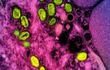 Partículas de viruela del mono (en verde) en una célula infectada.