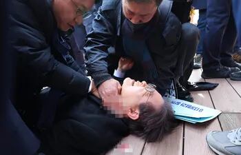 El líder del Partido Democrático (PD) surcoreano, Lee Jae-myung tras ser apuñalado este martes en el cuello durante un acto público en la ciudad de Busan y desde donde ha sido trasladado a la capital surcoreana para ser operado de urgencia debido al grave daño en la yugular.