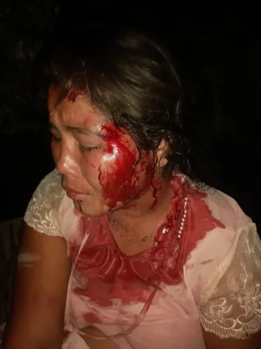 La víctima Yessica Isasi Duarte (20), cuando recibió la brutal golpiza de parte de su concubino, realizó 2 denuncias y hasta ahora la fiscalía no actúa, por lo que teme por su vida y la de su hijo.