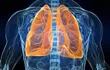 el-enfisema-es-una-enfermedad-pulmonar-en-la-que-los-alveolos-es-decir-las-bolsitas-de-aire-de-los-pulmones-se-obstruyen-por-lo-tanto-el-organism-214322000000-1357208.jpg