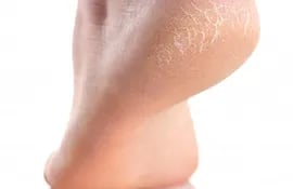 Recomendaciones para mantener la piel de los pies saludable y evitar los talones agrietados