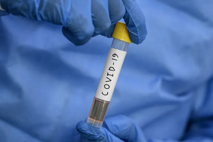 En Paraguay se están analizando varios fármacos para el tratamiento del COVID-19.
