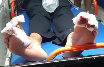 Las pirañas destruyeron cuatro dedos de los pies de una mujer adulta en la tarde del martes. Fue sometida a cirugía reconstructiva.