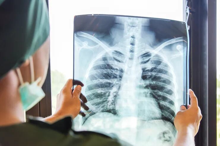 Una imagen de referencia sobre un profesional analizando una radiografía.
