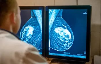 Un médico examina una mamografía.