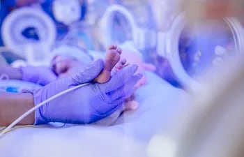 Imagen ilustrativa de un bebé en una incubadora. La mayoría de los siameses nacidos en Paraguay perdieron la vida antes o después de la cirugía de separación.