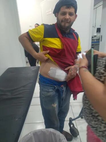 Lino Damián Barreto Monges (27) sufrió una herida en el abdomen.