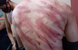 La espalda lacerada de una de las supuestas víctimas de tortura.