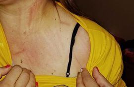La licenciada Teresa Medina exhibió foto de que también fue víctima de agresión