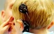 el-implante-coclear-es-un-dispositivo-tecnologico-implantable-que-permite-a-las-personas-escuchar-gracias-a-que-estimula-el-nervio-auditivo-con-las-s-191957000000-1698333.jpg