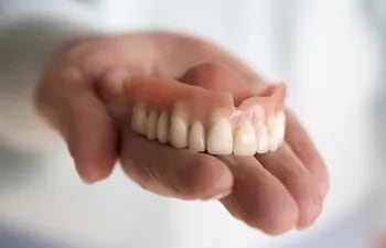 prótesprótesis dental, paladar, odontologíais dental