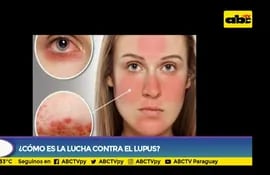 Cómo es la lucha contra el lupus