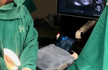 Momento de la  primera cirugía fetal intrauterina de derivación toracoamniótica. (gentileza).