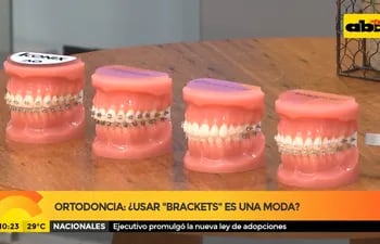 Ortodoncia: ¿Usar brackets es una moda?