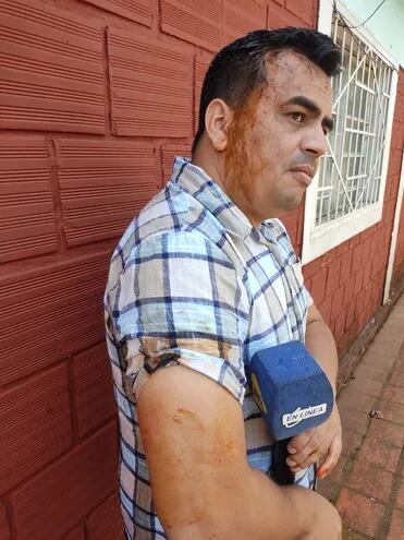 Darío Giménez, periodista agredido durante allanamientos a Municipalidad de Jesús.