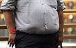 Una persona con obesidad.