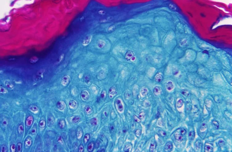 Imagen ampliada con un microscopio de una muestra de piel de un mono infectado con el virus de la viruela del mono.  (EFE)