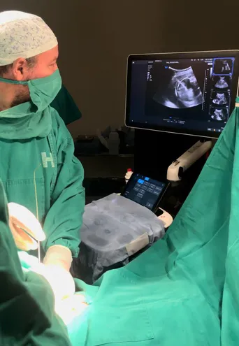 Momento de la  primera cirugía fetal intrauterina de derivación toracoamniótica. (gentileza).