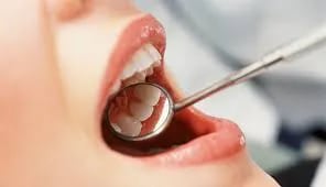Recuerde prestarle a su boca la misma atención que le presta al resto de su cuerpo, con una visita periódica al dentista y una higiene bucal impecable.