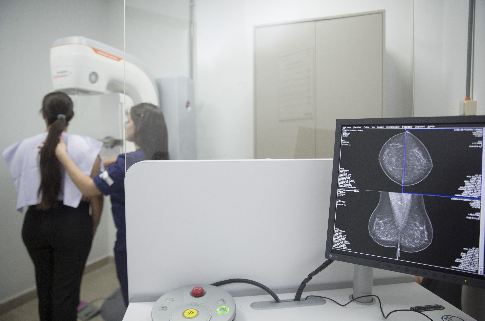 El nuevo mamógrafo instalado es uno de los últimos lanzamientos a nivel mundial, primero en Paraguay y uno de los primeros en Sudamérica.