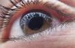 el-glaucoma-es-una-patologia-que-si-no-es-diagnosticada-a-tiempo-puede-llevar-a-la-ceguera-irreversible-lastimosamente-en-la-mayoria-de-los-casos-no-221142000000-1561845.jpg