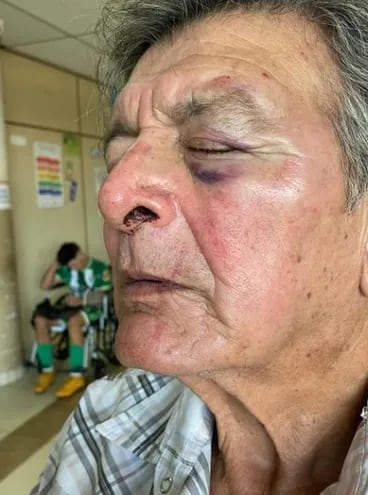 Ramón Ferreria (71) fue agredido en plena calle cerca de la Estación de Buses de Asunción (EBA). (Fuente: Instagram)
