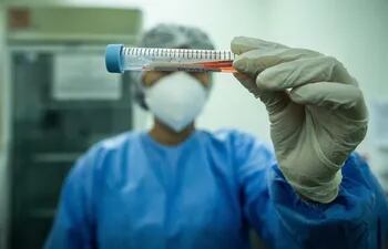 Además de los reactivos, la OPS capacitó a una profesional del Laboratorio Central para la detección de casos de viruela de mono, según el Ministerio de Salud.