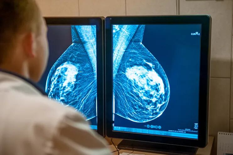 Un médico examina una mamografía.