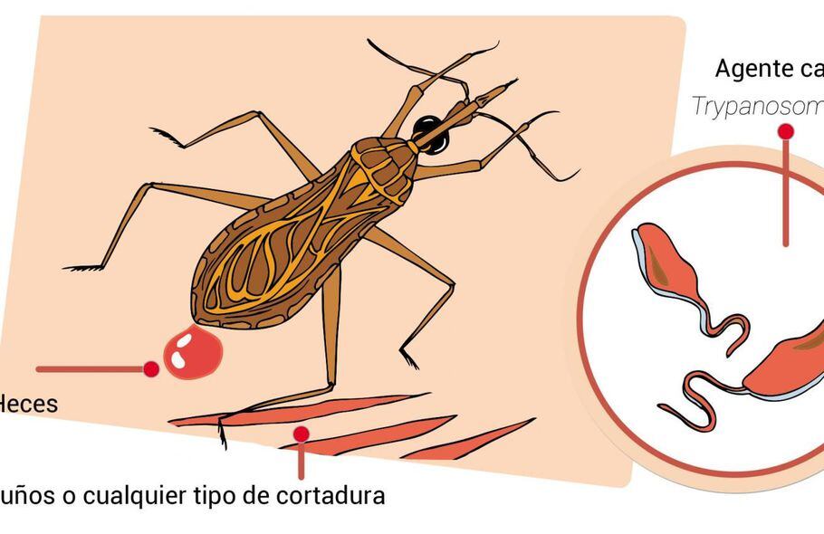 Mal De Chagas Escolar Abc Color