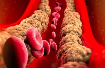 Un grupo de científicos de Viena ha hallado evidencias de que los fármacos clásicos para reducir el colesterol, las estatinas, tienen también un efecto secundario positivo al “matar células vasculares envejecidas”.