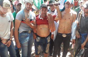 Campesinos muestran sus heridas producidas tras los incidentes.