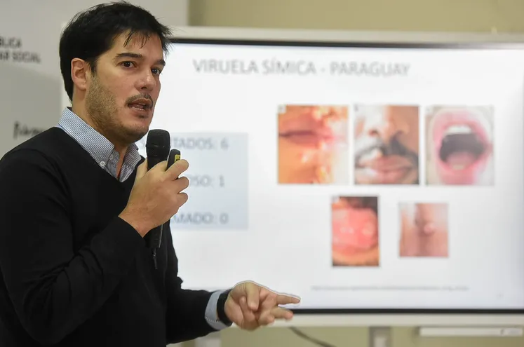 El doctor Guillermo Sequera, director de Vigilancia de la Salud, durante el reporte epidemiológico del ministerio de Salud
