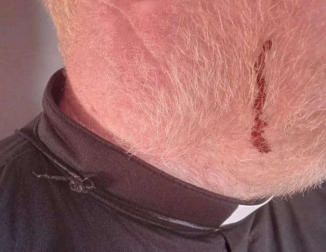 El sacerdote fue agredido en el rostro por los manifestantes en un punto de protesta en Itakyry.