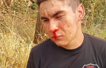 Uno de los guardias de la seguridad golpeado por los campesinos de Estancia Pindó