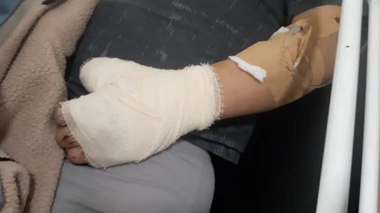 Brígido Ariel Díaz Resquín sufrió la amputación de un dedo de la mano a raíz de las heridas.