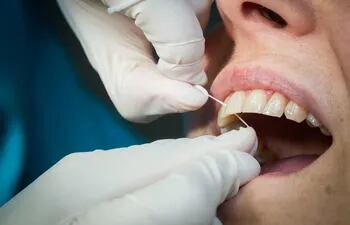 la-limpieza-profesional-de-los-dientes-es-una-gran-ayuda-para-mantener-la-higiene-bucal--125322000000-1707563.jpeg