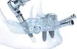 implantes-dentales-sin-cortes-213743000000-1702457.jpg