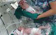 Las trillizas nacieron el lunes último en el Hospital Materno Infantil San Pablo.